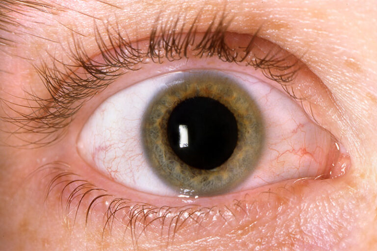 Why Do Pupils Dilate in Response to Emotional States? World Wise News