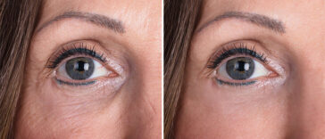 Do Antioxidants Actually Reverse The Appearance Of Aging?