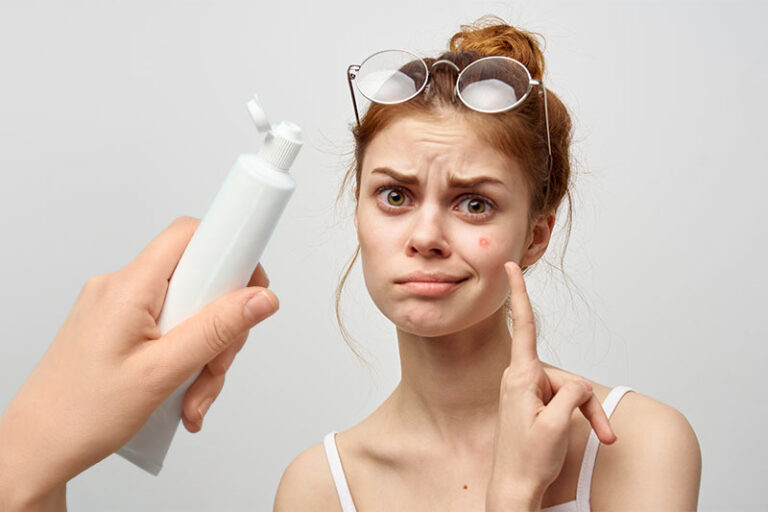 Putting Toothpaste On A Pimple Is Riskier Than You Think World Wise News