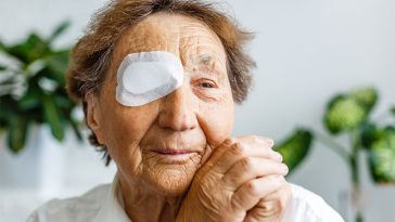 3 Unexpected Benefits of Cataract Surgery You Never Knew About!