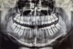 Researchers Have Found A Way To Regrow Teeth