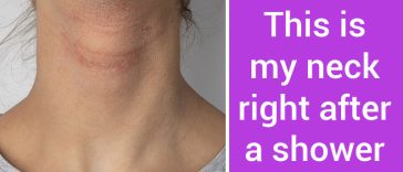 Experts Sound the Alarm: Daily Showering is a Recipe for Skin Disaster