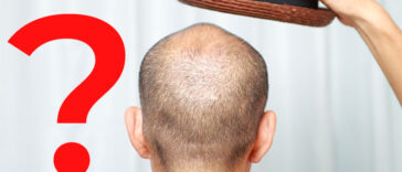 Is It Possible For Hats To Cause Hair Loss?