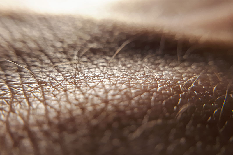 Scientists Reduce the Age  Of Human Skin Cells by Making Them Act 30 Years Younger