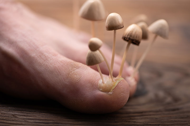 12 Signs Fungus Might Be Taking Over Your Body