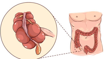Your Appendix May Not Be Useless After All
