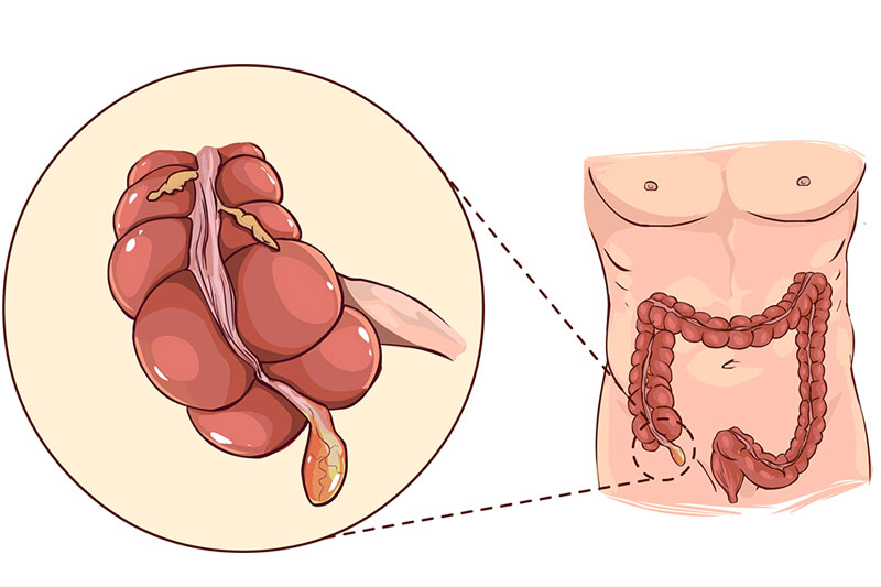 Your Appendix May Not Be Useless After All