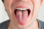 This Is What A White Tongue Says About Your Health! Very Few People Know This!