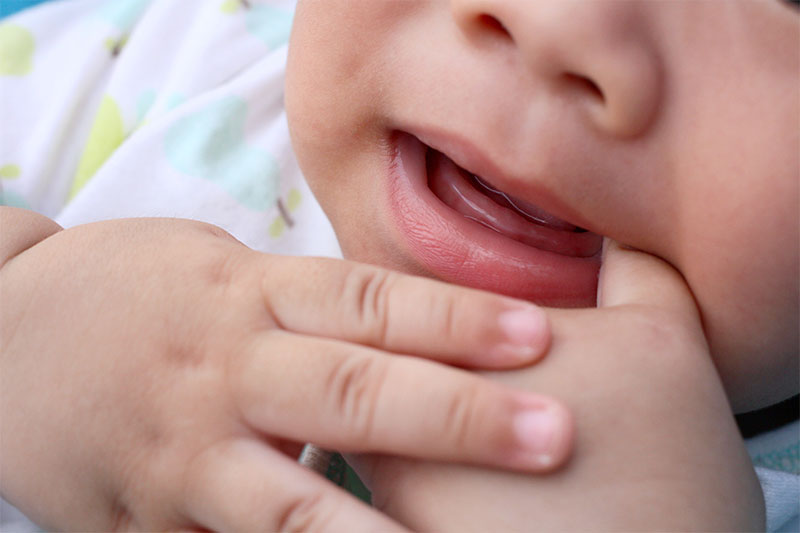 Teething Babies Had To Have Their Gums Cut