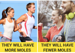 What Should You Do When You Find a New Mole? Why Appear And How To Identify Them