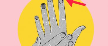 5 Ingrown Fingernail Treatments You Must Try at Home