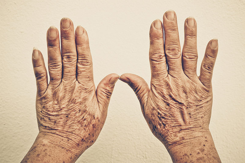 Are Your Hands Starting To Look Older? These Are The Reasons Why
