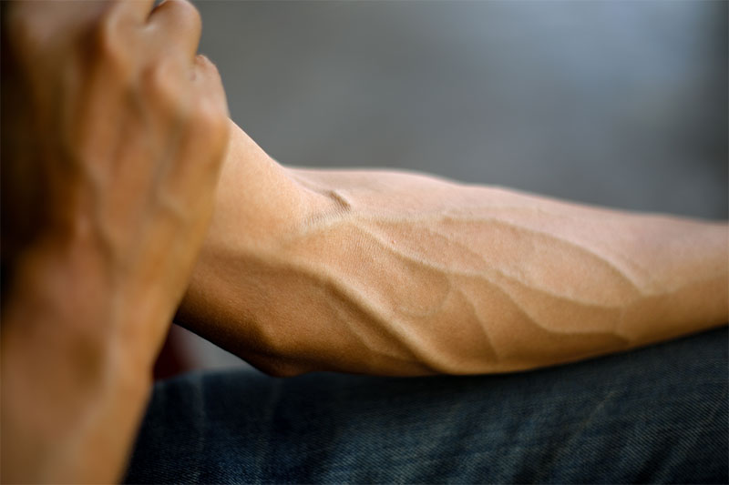 Forearm Artery Reveals Humans Evolving From Changes in Natural Selection