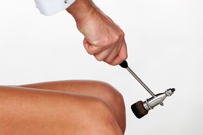 Why Does A Doctor Hit Your Knee During An Examination?