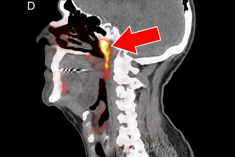 Did You Know That Your Head Has Another Organ In It That Scientists Discovered By A Fluke?